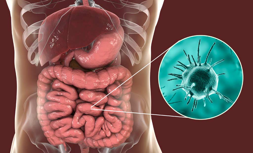 bacteria_virus_food_illness_safety